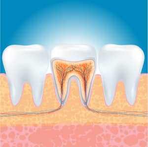 3-common-questions-about-root-canal-treatment