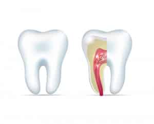 what-everyone-should-know-about-root-canals