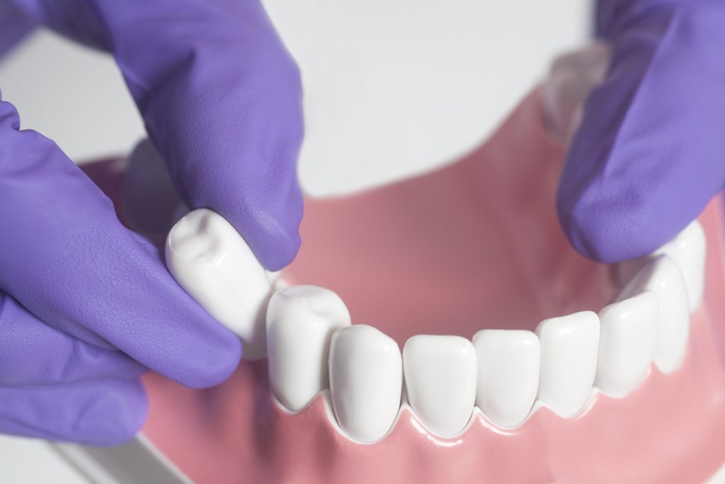 download dream about losing teeth for free download dream about losing teeth for free