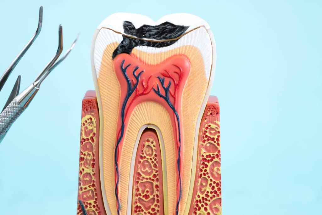 El Paso Dentists Explain What Happens When We Receive A Root Canal El