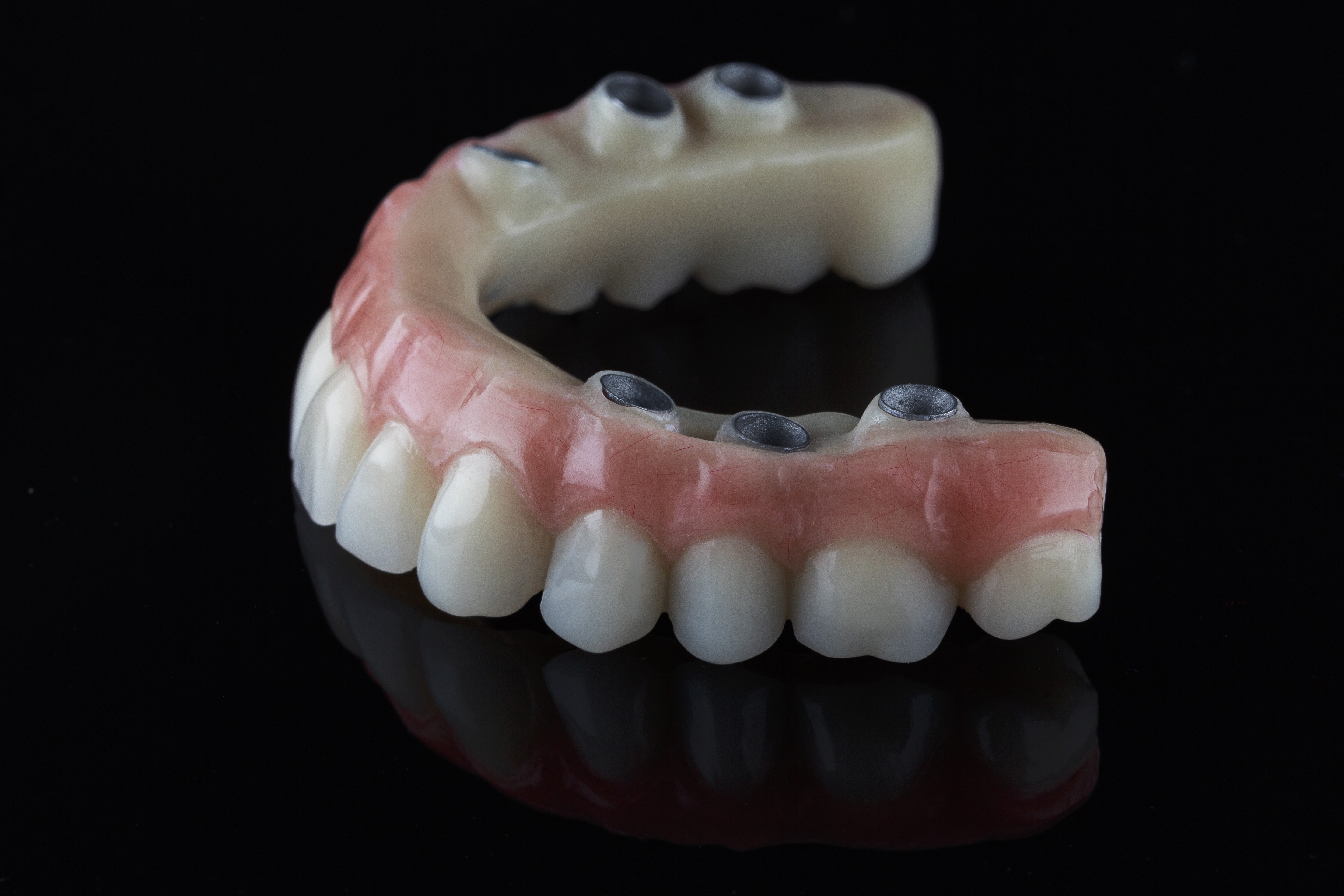 El Paso Dentists Can Secure Dentures With Dental Implants El Paso, TX