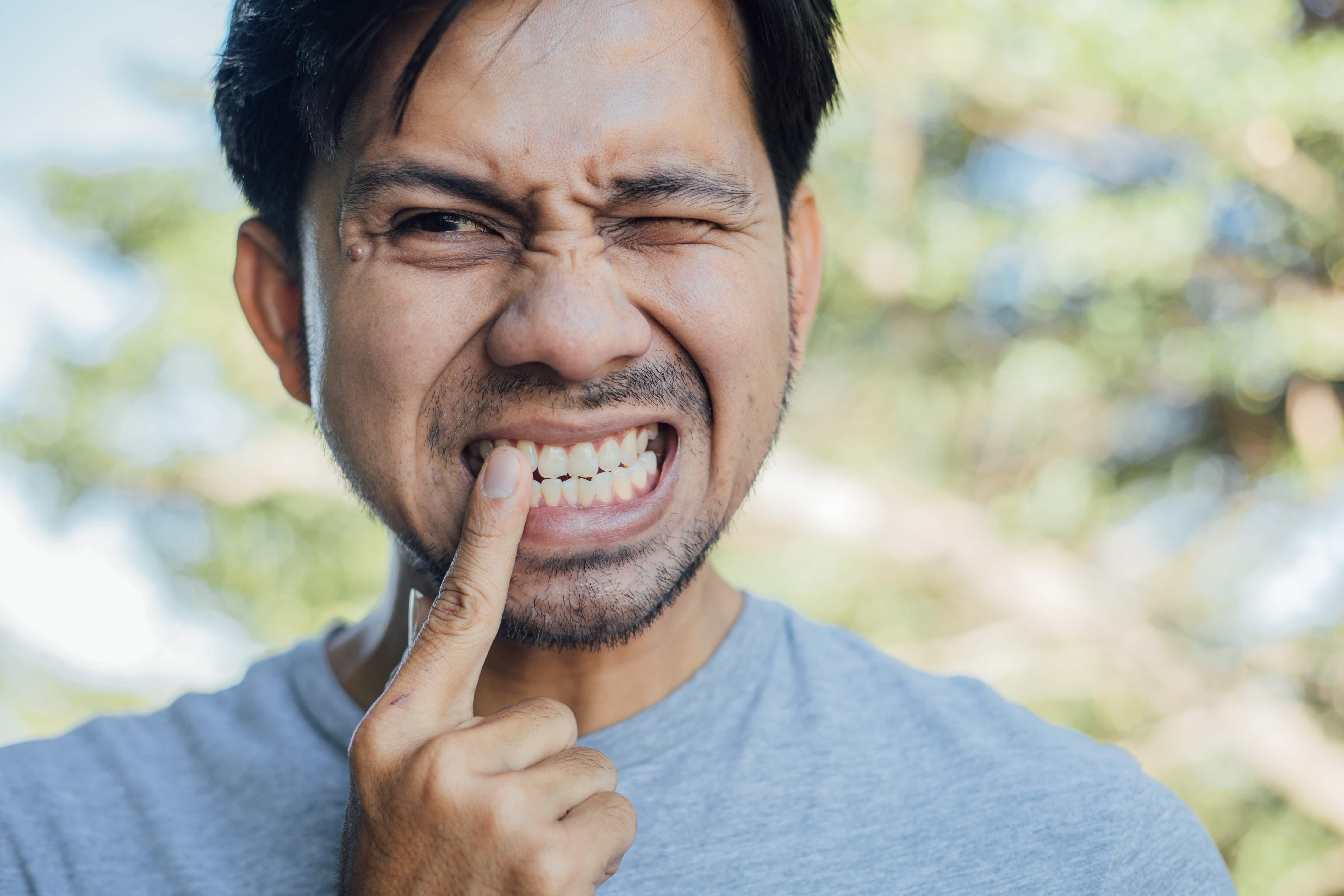 Is Your Toothache Bleach'S Fault?  Find Out Now! - jdrleua