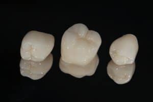 modern dental crowns