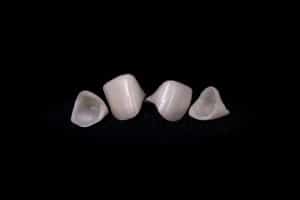 dental crowns