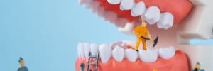 emergency repair with dental bonding