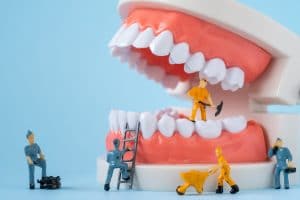 emergency repair with dental bonding