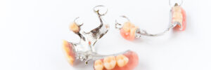 el paso partial dentures