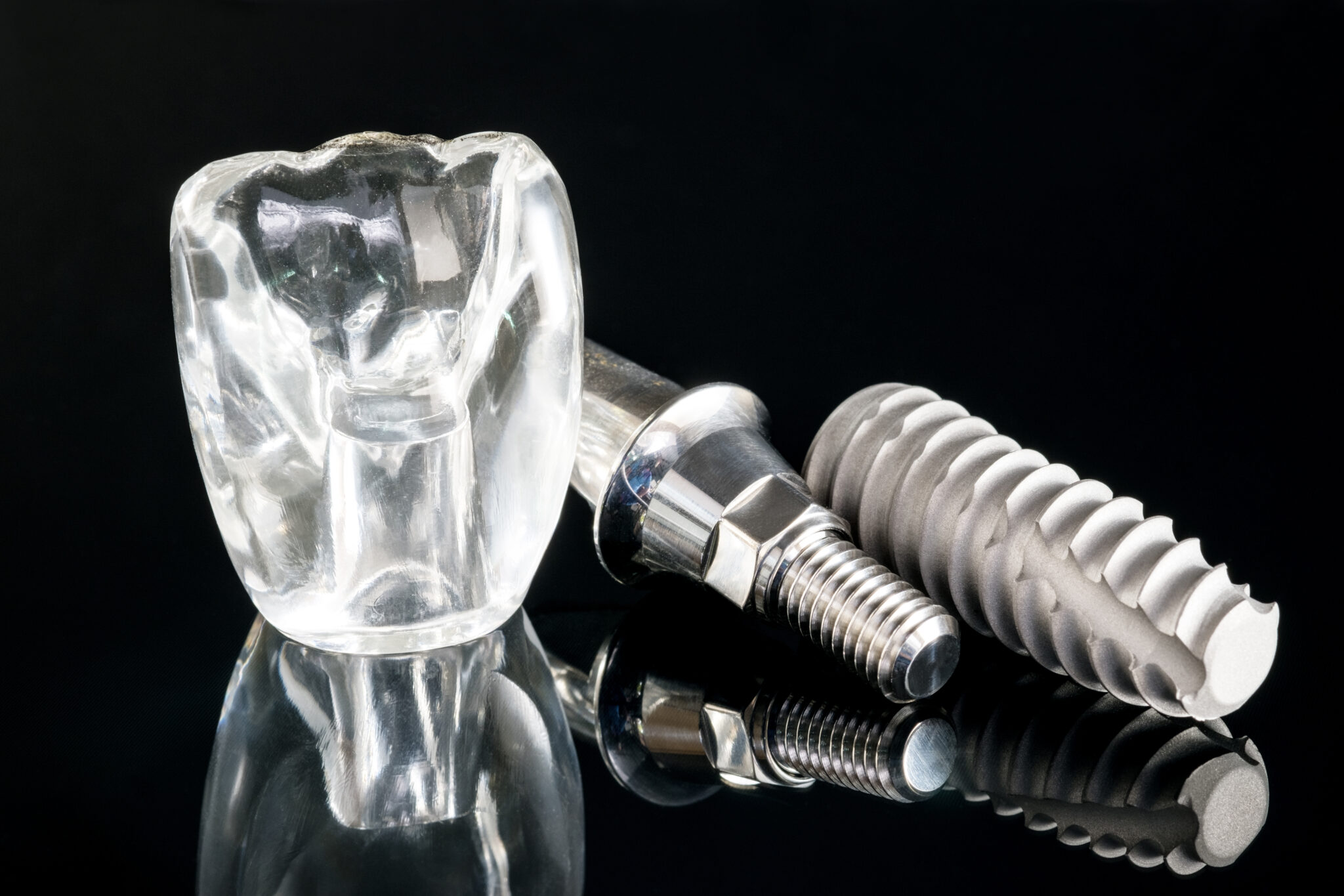 The Benefits Of SameDay Dental Implants El Paso, TX