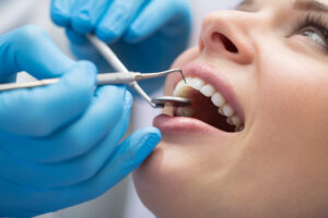 el paso dental cleaning