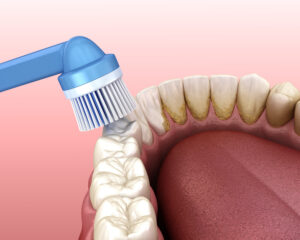 el paso dental cleaning