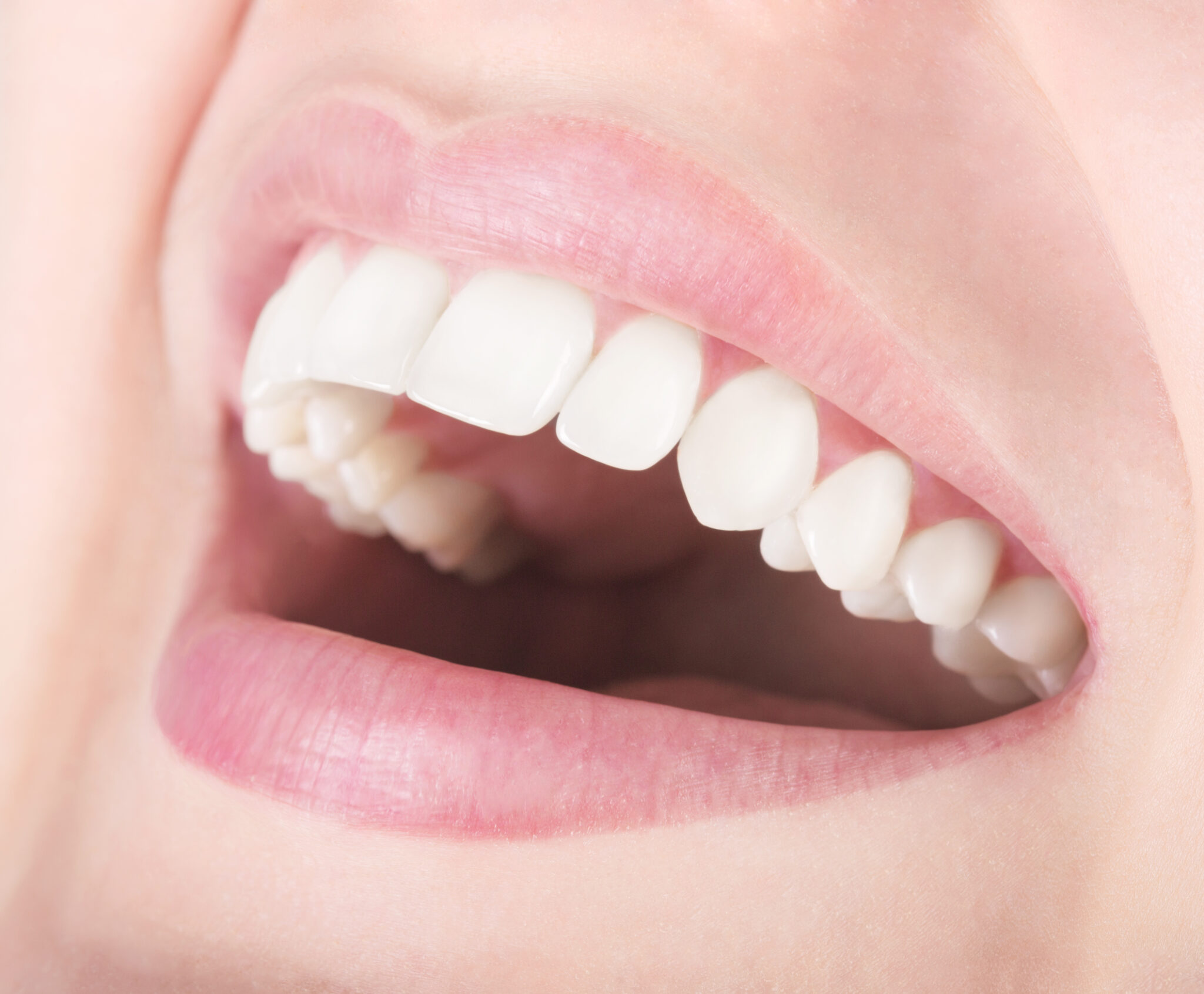 We Can Offer A Smile Makeover | El Paso, TX
