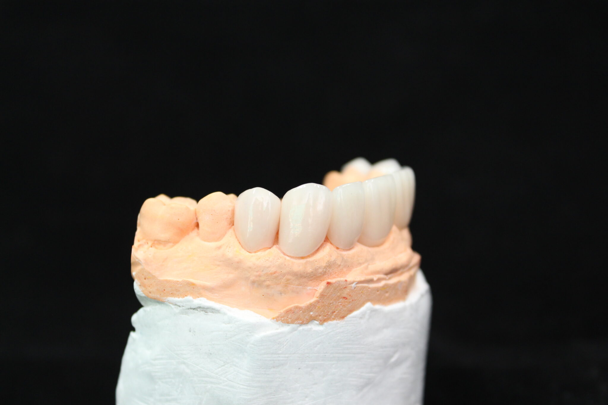 Boost Smile Beauty With Our Porcelain Veneers El Paso, TX