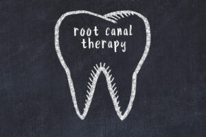 El Paso TX dentist offers root canal therapy 