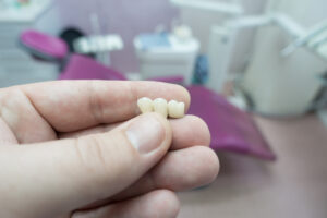 el paso dental bridge