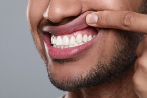 El Paso, TX, dentist offers periodontal care 