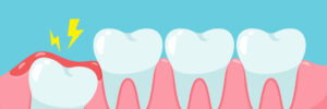 El Paso, TX, dentist offers wisdom tooth extraction
