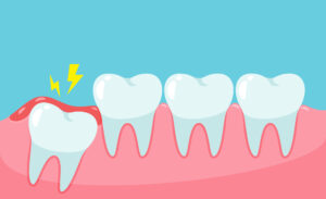 El Paso, TX, dentist offers wisdom tooth extraction