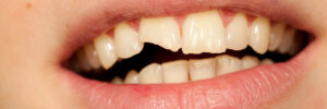 El Paso, TX, dentist offers restorations for patients